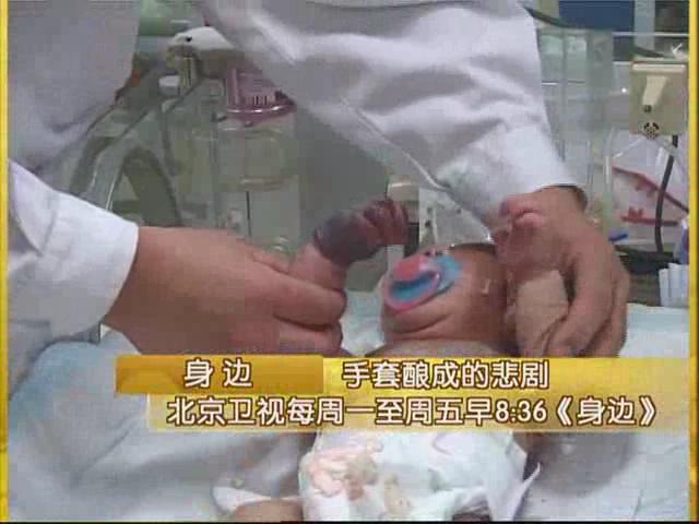 BTV-《身边》“小黑手”