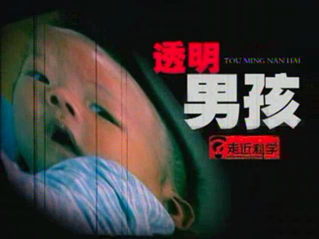 透明男孩