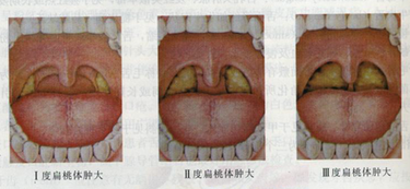 图片12.png 图片12.png