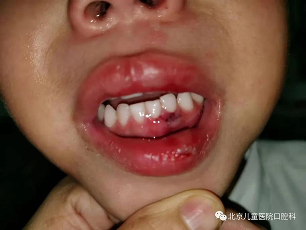 图片 30.png 图片 30.png