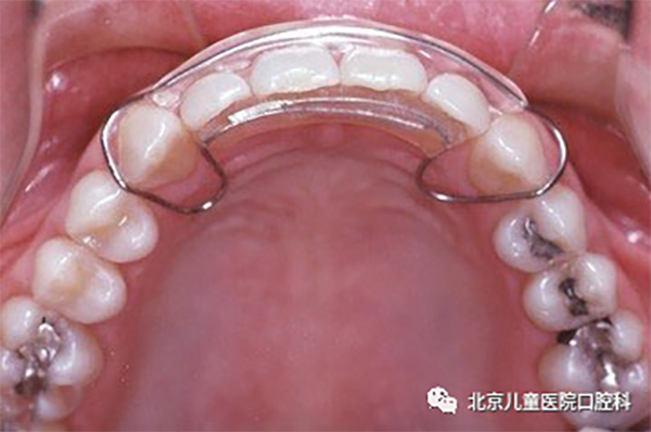 图片 45.png 图片 45.png