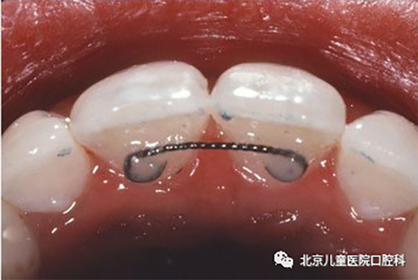 图片 49.png 图片 49.png