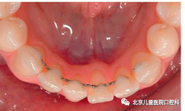 图片 50.png 图片 50.png