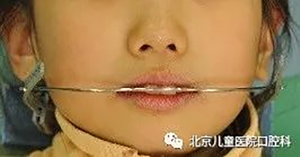 图片 156.png 图片 156.png