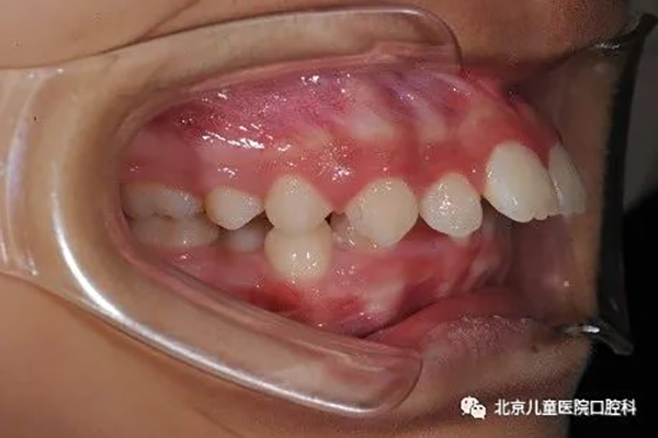 图片 157.png 图片 157.png