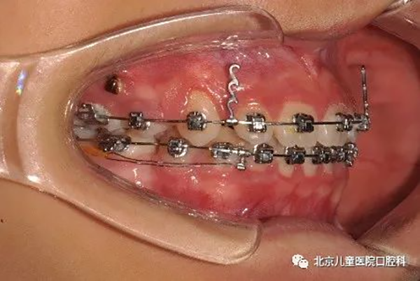 图片 158.png 图片 158.png