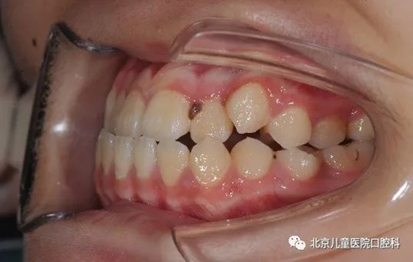 图片 159.png 图片 159.png