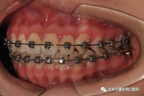 图片 160.png 图片 160.png