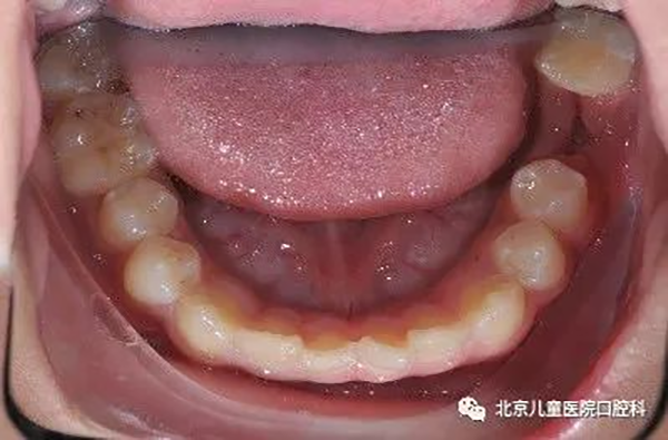 图片 161.png 图片 161.png