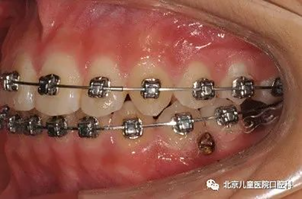 图片 162.png 图片 162.png