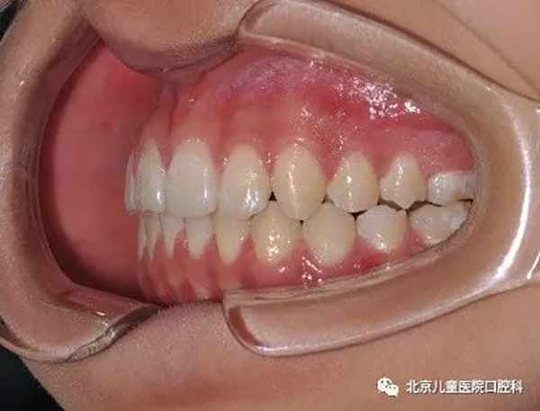 图片 163.png 图片 163.png