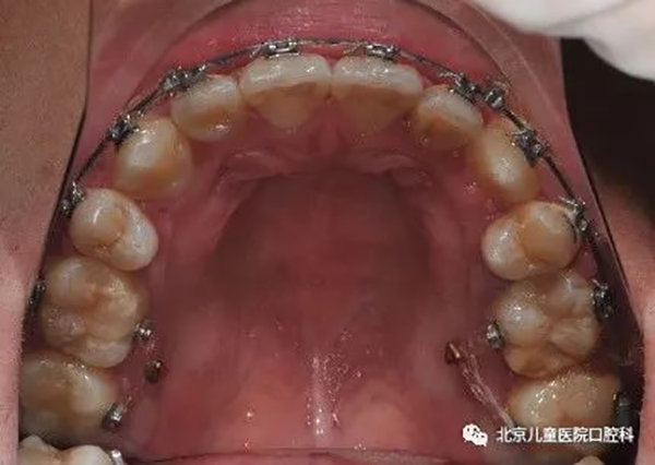 图片 164.png 图片 164.png