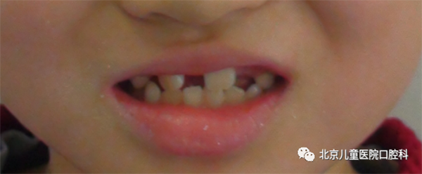 图片 178.png 图片 178.png