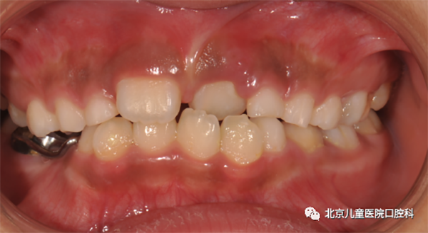 图片 179.png 图片 179.png