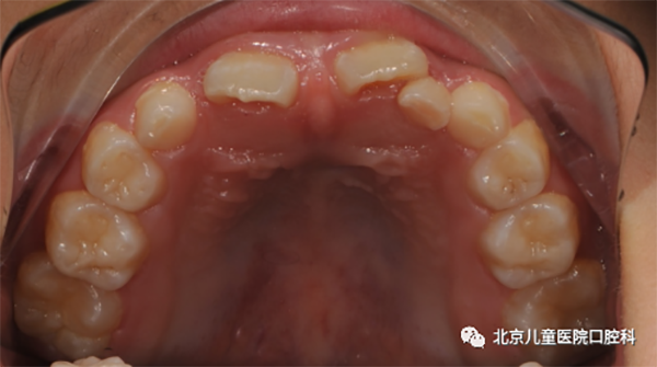 图片 180.png 图片 180.png