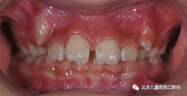 图片 181.png 图片 181.png