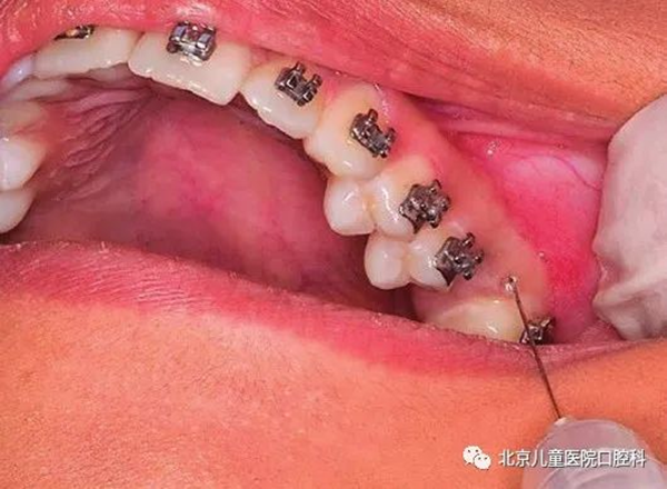 图片 184.png 图片 184.png