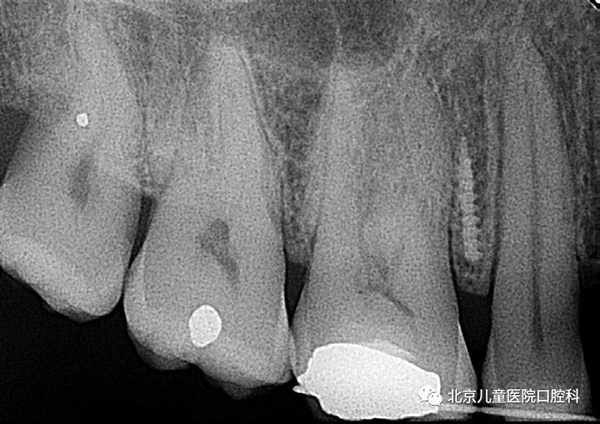 图片 185.png 图片 185.png