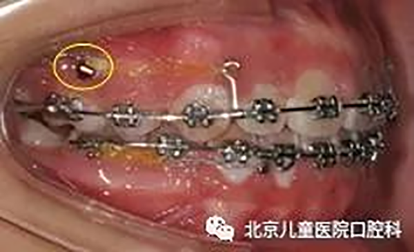 图片 186.png 图片 186.png