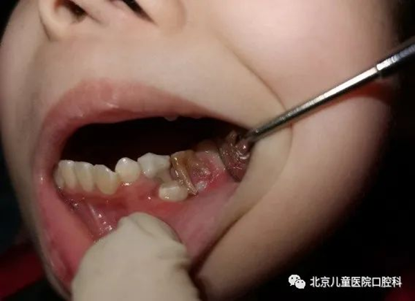 图片 190.png 图片 190.png