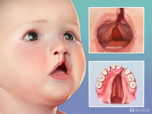 图片 206.png 图片 206.png