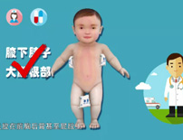 冰袋怎么敷？方法正确才不适得其反