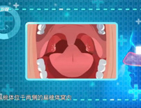 扁桃体发炎的影响